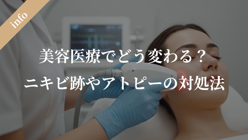 皮膚のターンオーバーと再生期間｜ニキビ跡やアトピーなどの悩み、美容医療でどう変わる？