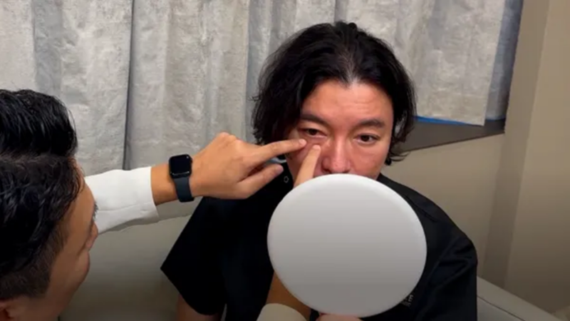 表面に傷は作らない。名医がこだわる「結膜アプローチ」と解剖学