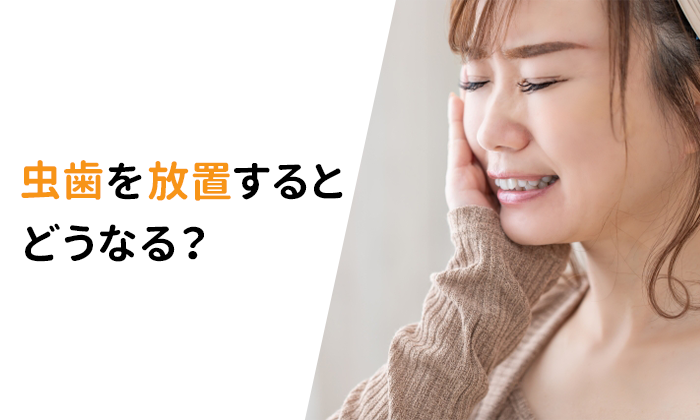 虫歯を放置するとどうなる？放置リスクを徹底解説