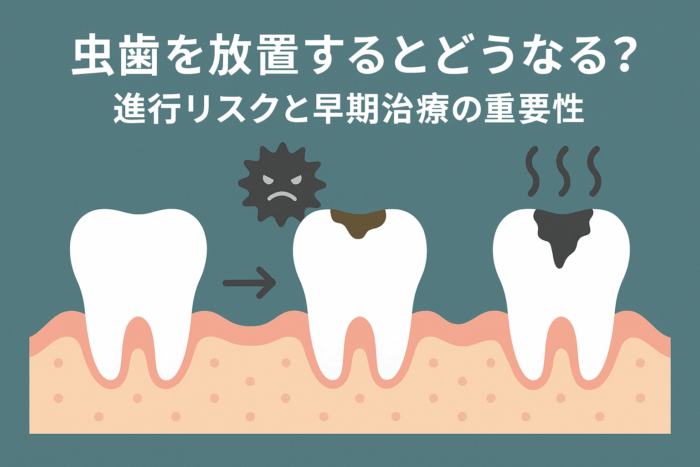 虫歯を放置するとどうなる？進行リスクと早期治療の重要性