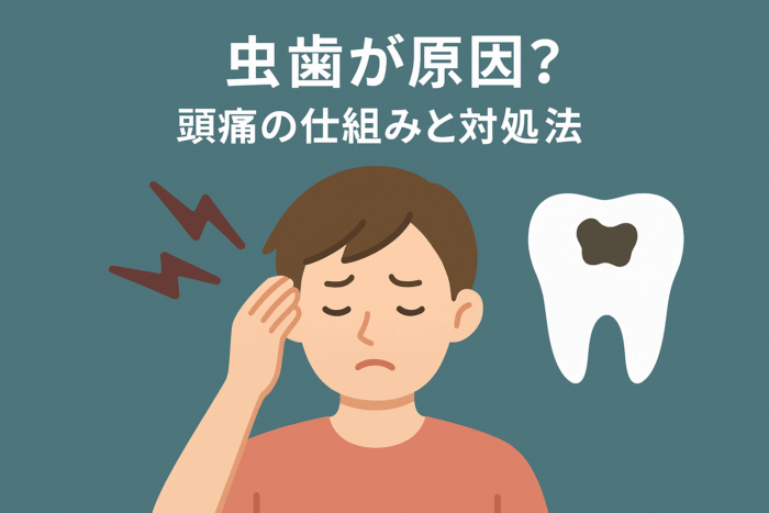 虫歯が原因？頭痛の仕組みと対処法