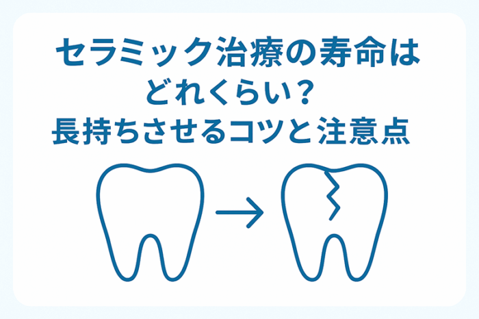 セラミック治療の寿命はどれくらい？長持ちさせるコツと注意点